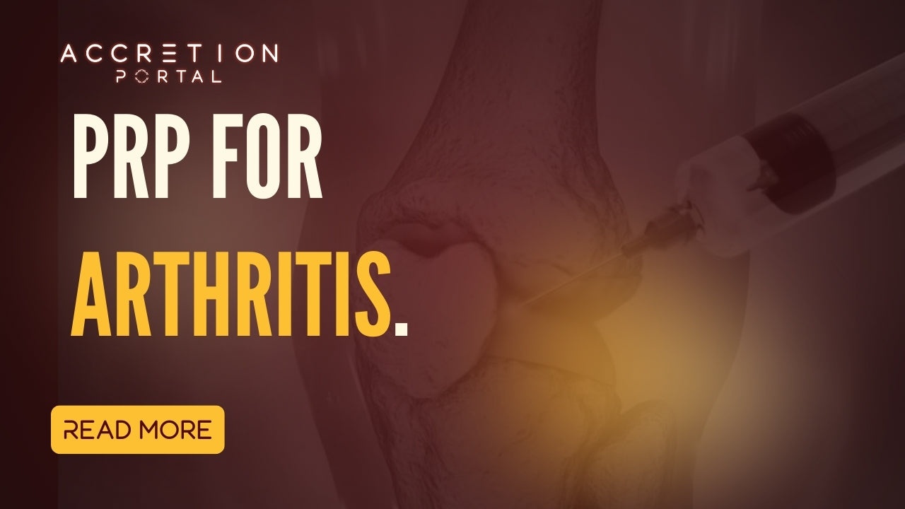 PRP for Arthritis | Clinical Use in Joint Care