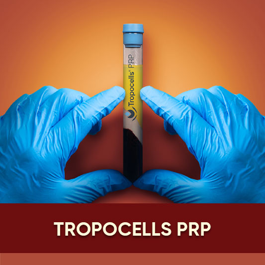 Tropocells PRP